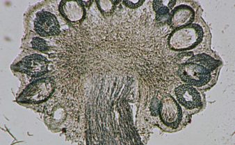 Foto da imagem de microscópio do fungo cravagem ou esporão-de-centeio
