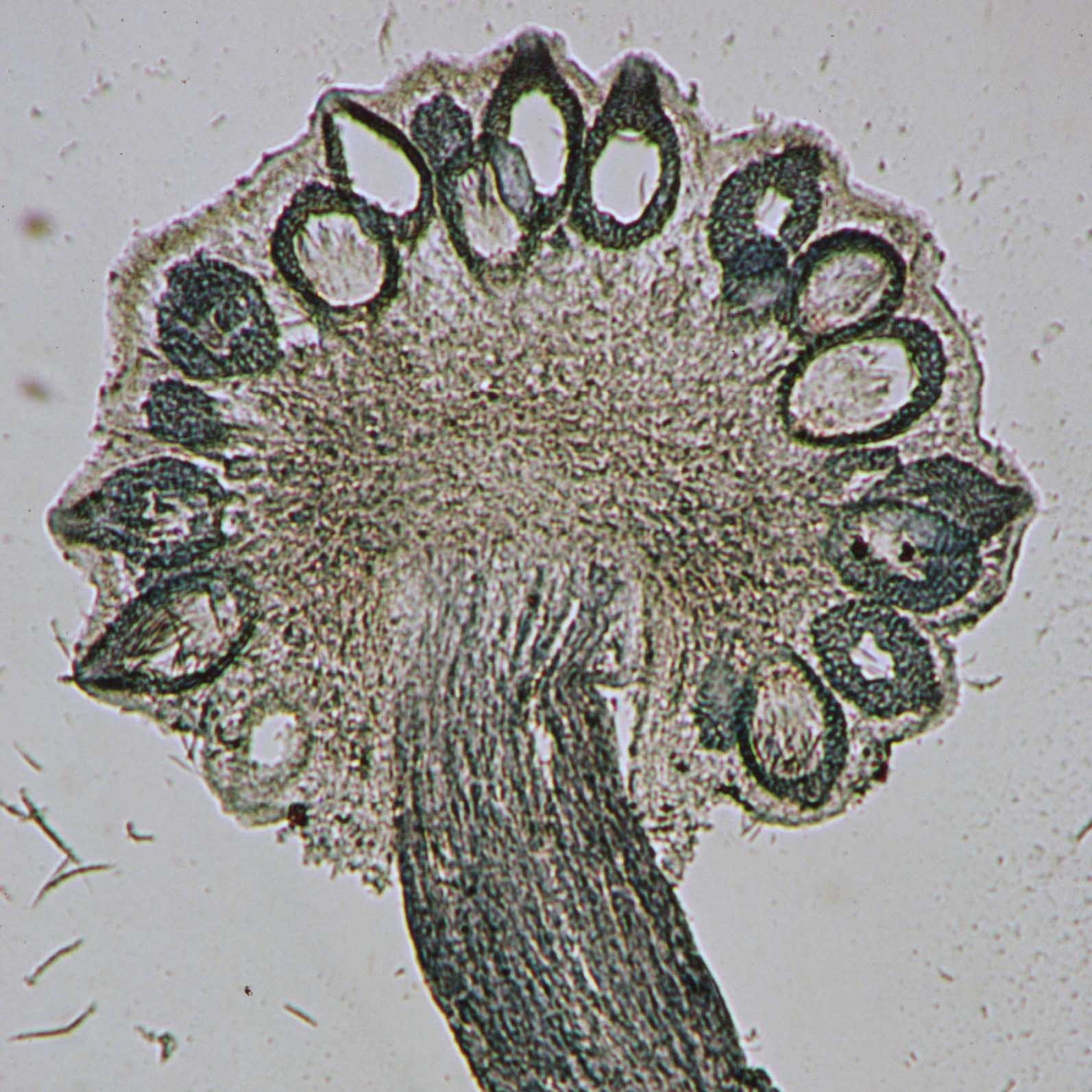 Foto da imagem de microscópio do fungo cravagem ou esporão-de-centeio