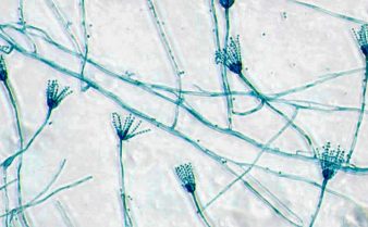 Foto da imagem de microscópio de fungos do gênero Penicillium