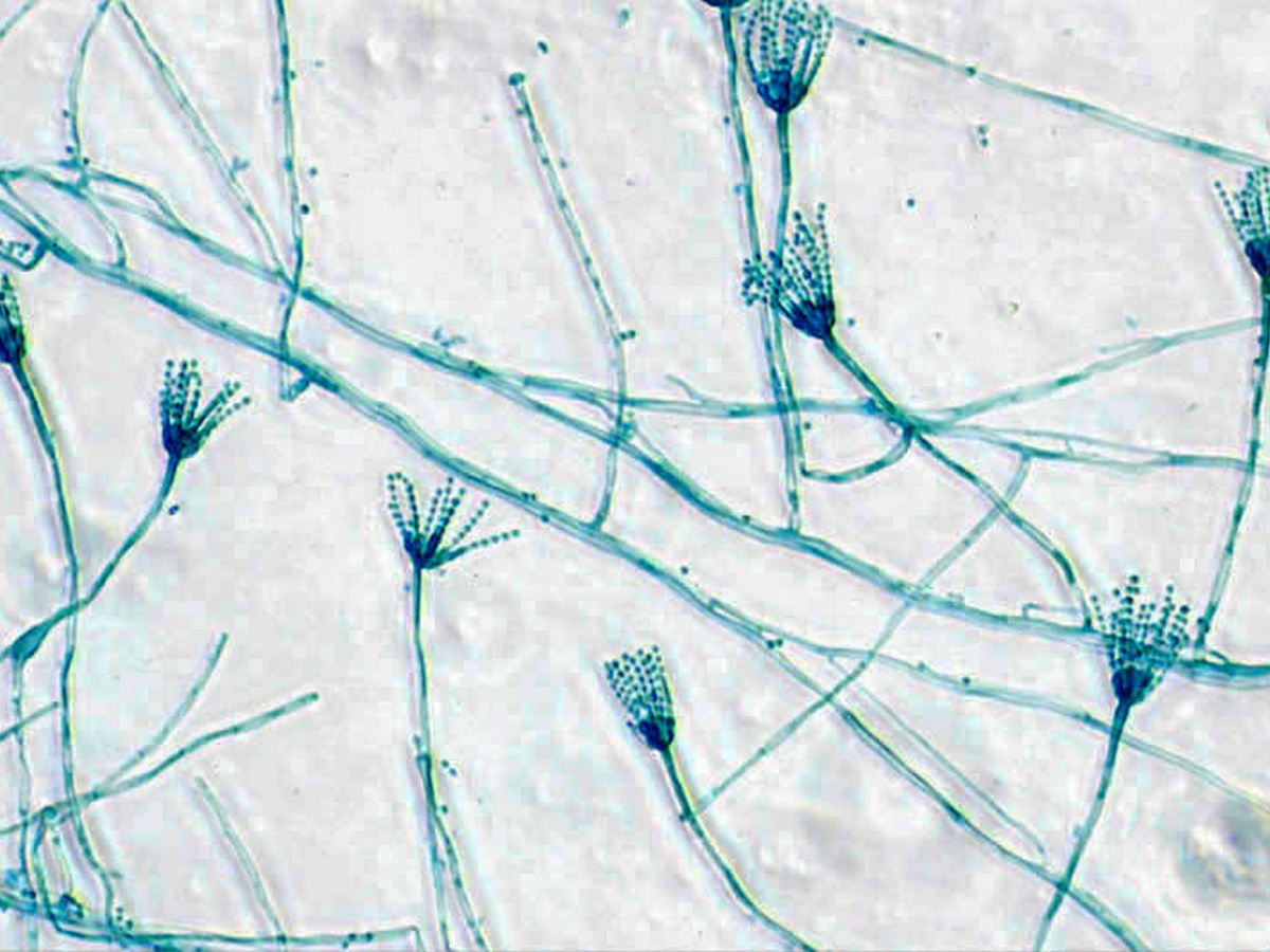 Foto da imagem de microscópio de fungos do gênero Penicillium