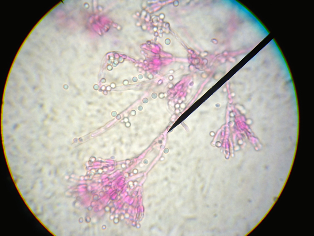 Foto da imagem de microscópio da cultura em laboratório do fungo Penicillium chrysogenum