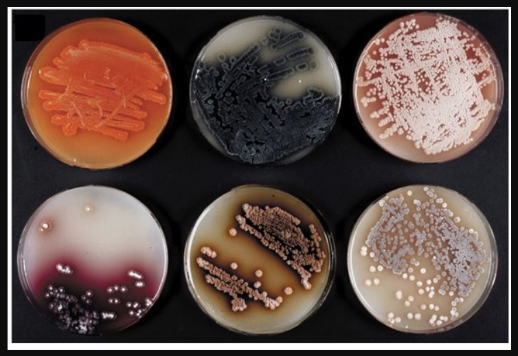 Foto vista de cima de seis placas de vidro com bactérias Streptomyces isoladas em diferentes estágios