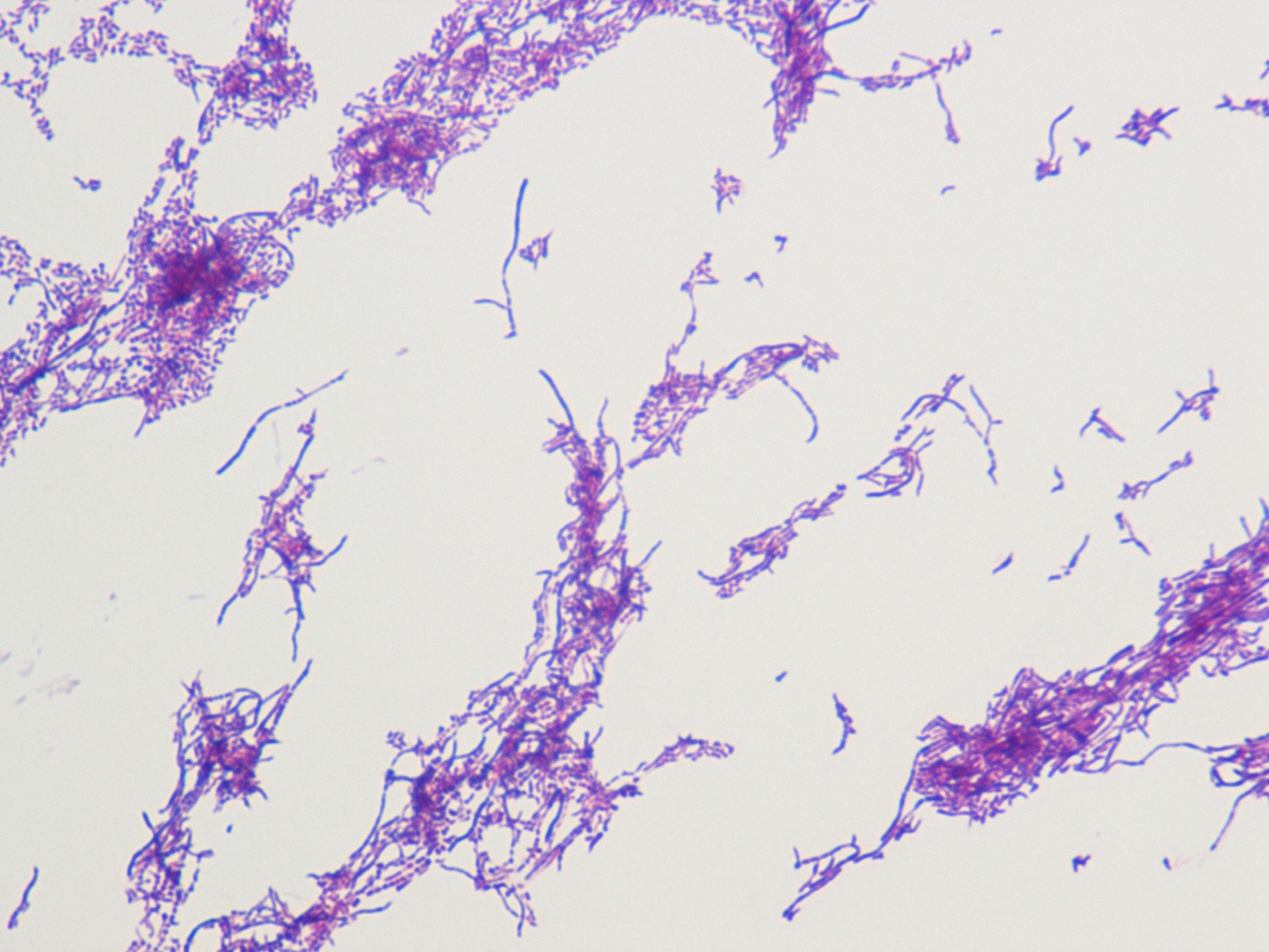 Foto da imagem de microscópio da cultura de bactéria do gênero Streptomyces