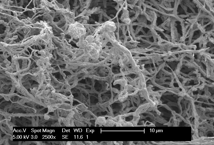 Foto de micrografia eletrônica em preto e branco  de cultura bacteriológica para produção de eritromicina
