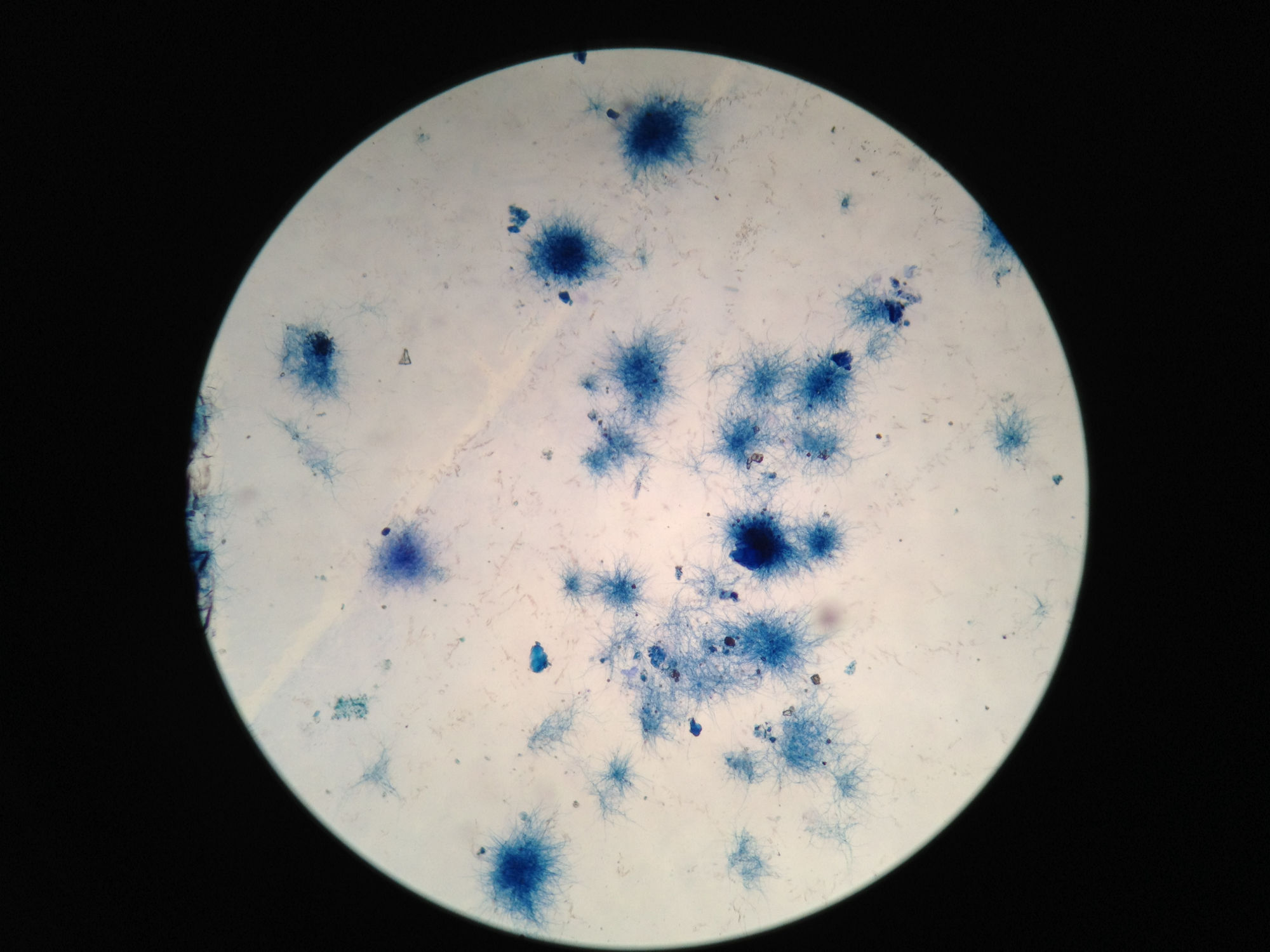 Foto da imagem de microscópio da cultura em laboratório da bactéria Saccharopolyspora erythraea
