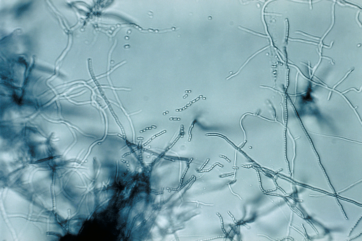 Foto da imagem de microscópio da cultura em laboratório da bactéria Streptomyces sp.